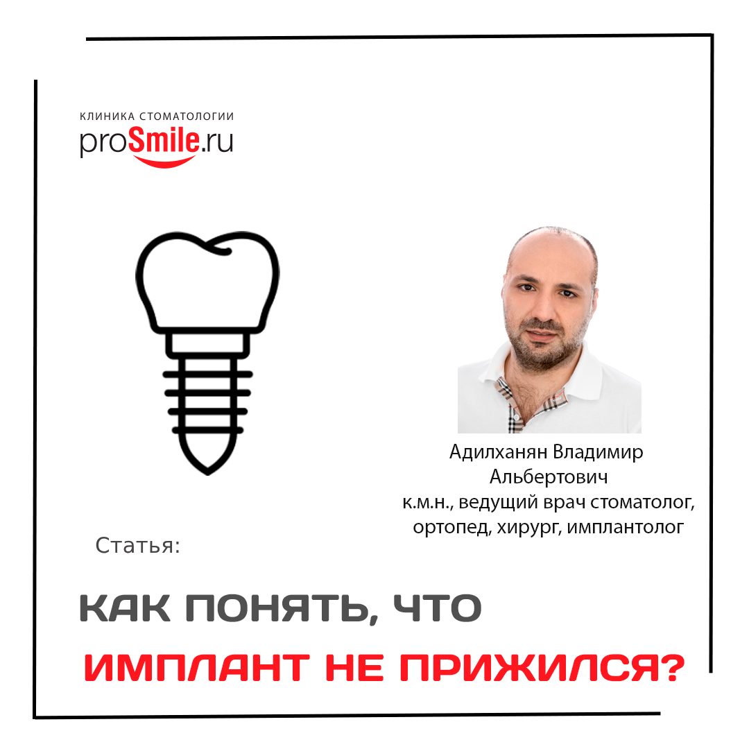 Как понять, что имплантат не прижился? Какие симптомы у не прижившегося имплантата?