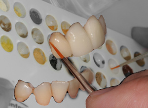 Зуботехническая лаборатория клиники стоматологии ProSmile.Ru